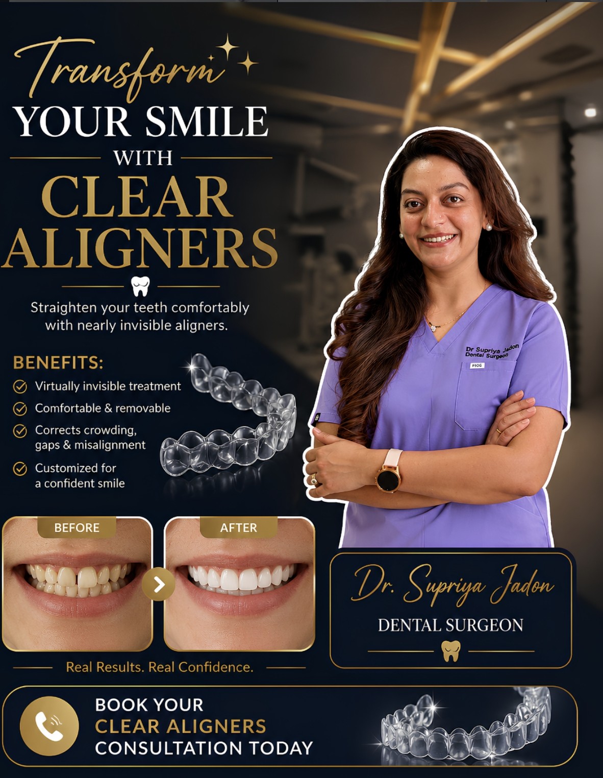 Clear Aligners