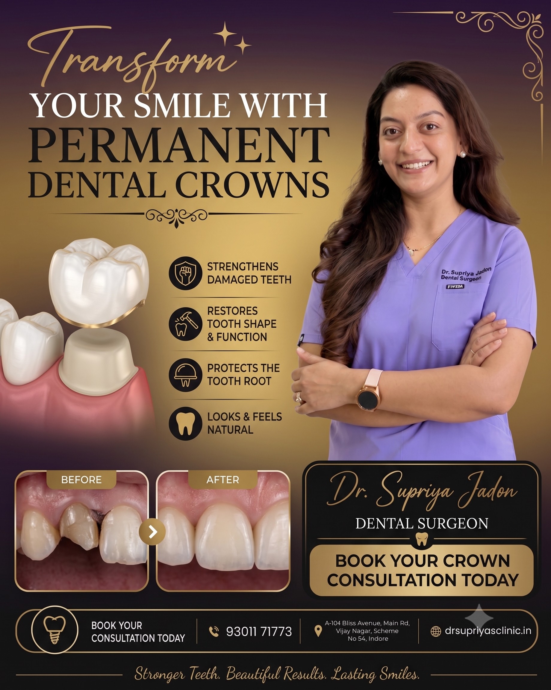 Dental Crowns