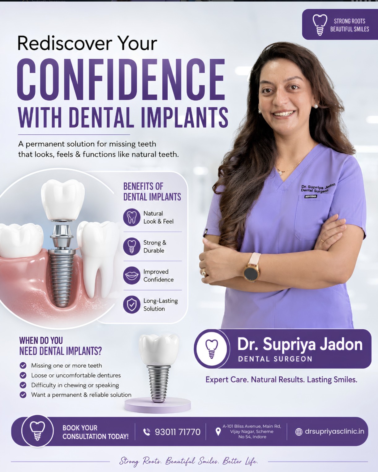 Dental Implants